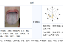 中医AI辅助辨证:一例阳虚兼气血亏虚病案解析-171主机测评