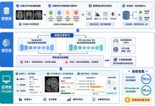 基于深度迁移学习的阿尔茨海默病MRI影像分类系统研究与实现-171主机测评