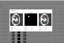 【免费】AI智能 医学肿瘤诊断、分割以及分析系统(U-Net+大模型+AI智能问答+PyTorch+LangChain+FastAPI+Vue3+Neo4j 知识图谱)毕业设计 锋哥原创出品,必属精品-171主机测评