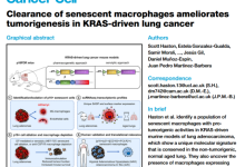Cancer Cell | KRAS肺癌进展之谜:衰老巨噬细胞促癌机制,Micro-CT 活体可视化证实-171主机测评